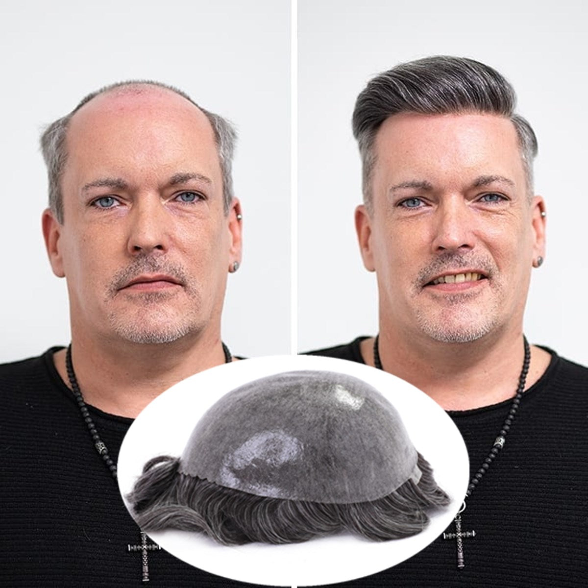 Hair Systems for Men tupehair