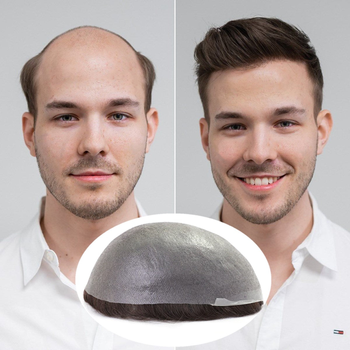 Just Hair Men's Toupee – Ultra Thin Skin Human Hair Replacement System, 6 Inch Slight Wavy